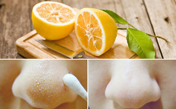 cach-tri-mun-cam-hieu-qua-bang-chanh cach-tri-mun-cam-hieu-qua-bang-chanh.png