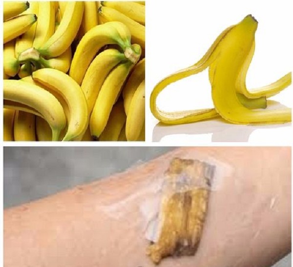 cach-tri-mun-coc-bang-chuoi cach-tri-mun-coc-bang-chuoi.jpg