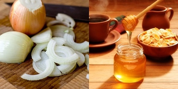 Trị sẹo lồi bằng hành tây và mật ong Trị sẹo lồi bằng hành tây và mật ong