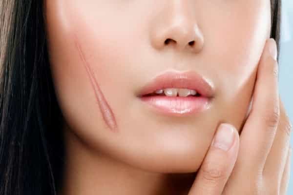 cach-tri-seo-loi-min-1 cach-tri-seo-loi-min.jpg