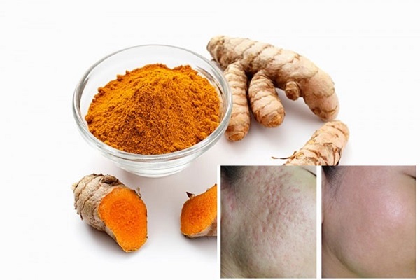 cach-tri-seo-lom-bang-nghe-1 cach-tri-seo-lom-bang-nghe.jpg