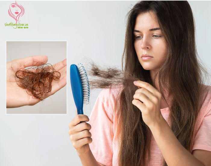 khai20quat20ve20hien20tuong20rung20toc Khai%20quat%20ve%20hien%20tuong%20rung%20toc.jpg