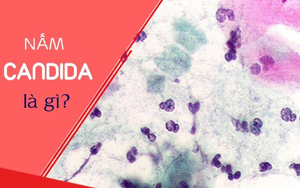 nam-candida-la-gi-1 nam-candida-la-gi.jpg