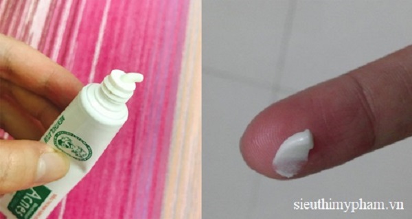 Chất kem khá đặc màu trắng đục kem-tri-mun-tot-nhat-acnes-medical-cream.jpg