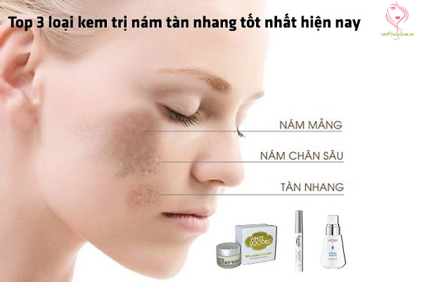 Top 3 loại kem trị nám tàn nhang tốt nhất hiện nay Top 3 loại kem trị nám tàn nhang tốt nhất hiện nay