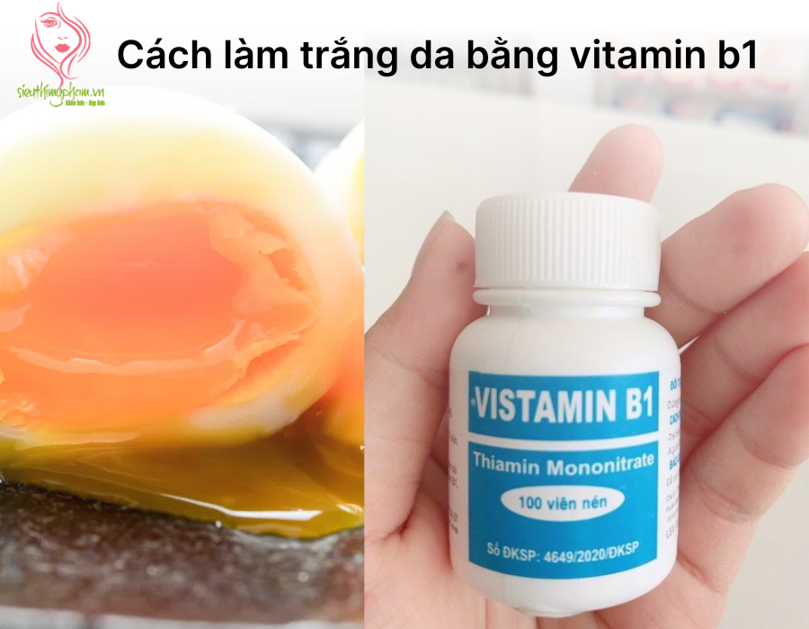 Cach%20lam%20trang%20da%20bang%20vitamin%20b1.png