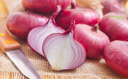 Cách trị sẹo thâm ở chân với hành tây đỏ