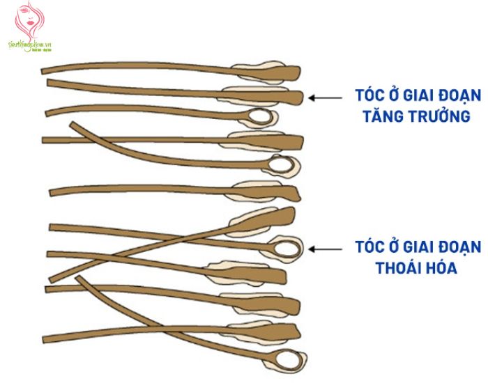 Qua%20trinh%20rung%20toc%20o%20nam%20gioi%20dien%20ra%20nhu%20the%20nao.jpg